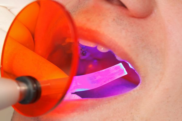 dobry stomatolog Wrocław